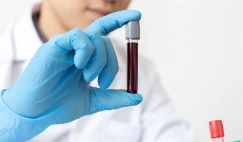 Monkeypox: sobe para 81 número de casos confirmados da varíola dos macacos no AM