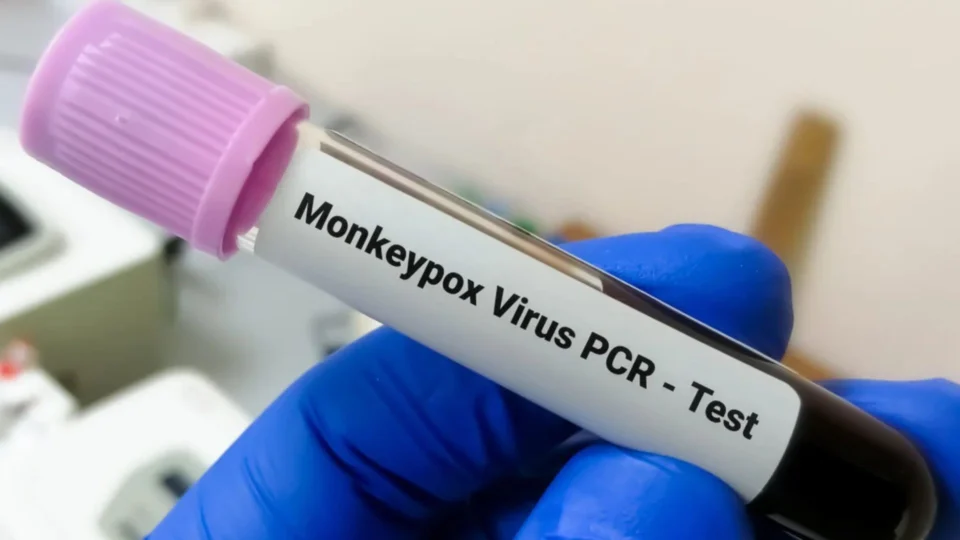 Monkeypox: Brasil investirá R$ 3 milhões em pesquisa sobre varíola dos macacos