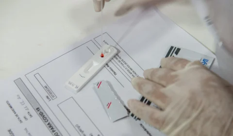 Amazonas registra 34 casos e nenhuma morte por Covid-19 neste domingo