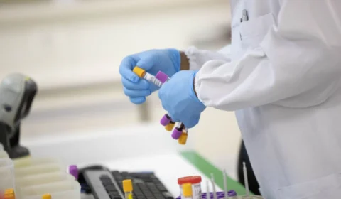 Monkeypox: sobe para 55 número de casos confirmados da varíola dos macacos no AM