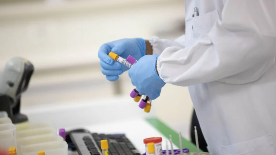 Monkeypox: sobe para 55 número de casos confirmados da varíola dos macacos no AM