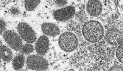 Amazonas registra quatro casos suspeitos de varíola dos macacos neste domingo