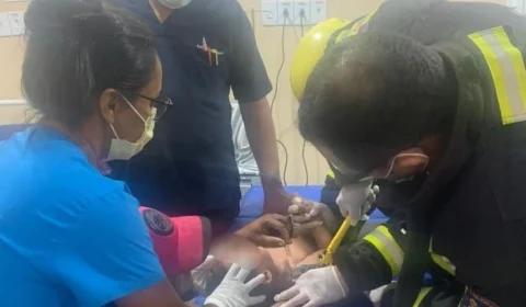 Acidente: criança tem peito perfurado com espeto de churrasco no interior do AM