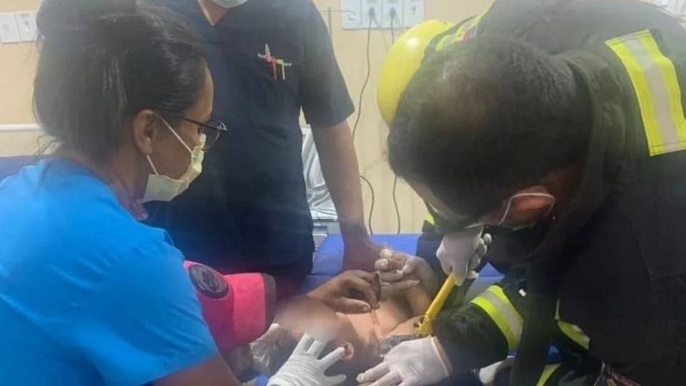 Acidente: criança tem peito perfurado com espeto de churrasco no interior do AM