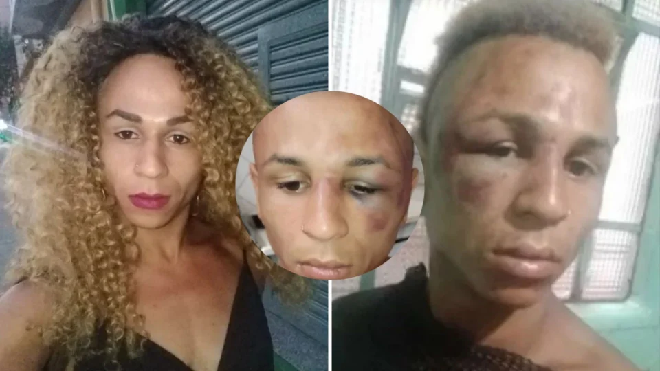 Mulher trans é vítima de espancamento em terminal de ônibus de SP