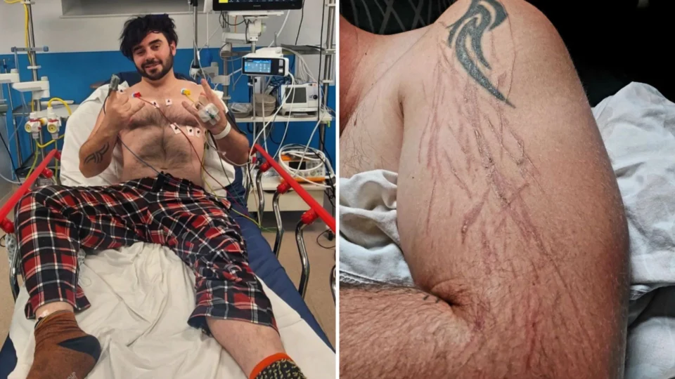 Homem é atingido por raio jogando videogame em casa e sobrevive, na Inglaterra