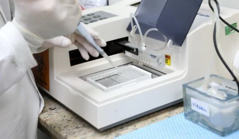 Amazonas não registra óbito por Covid-19 neste domingo