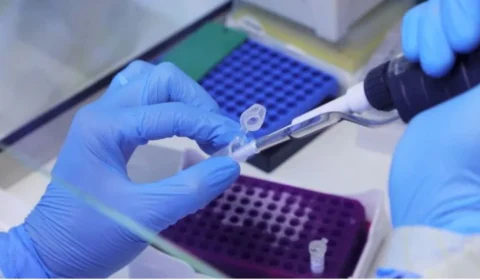 Saiba o que é mito ou verdade sobre varíola dos macacos