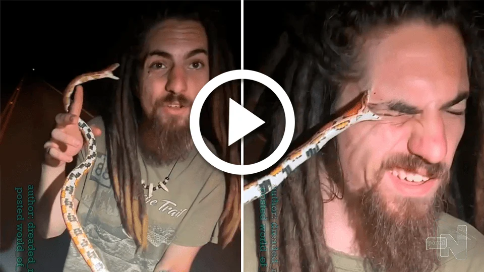 VÍDEO: veja momento em que cobra morde fotógrafo no olho, nos EUA