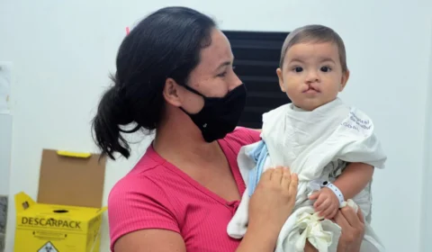 Avança proposta que obriga SUS oferecer plástica e pós-cirúrgico de lábio leporino