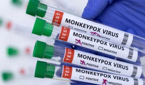 Três pessoas são monitoradas com sintomas da varíola dos macacos no Brasil, confirma MS