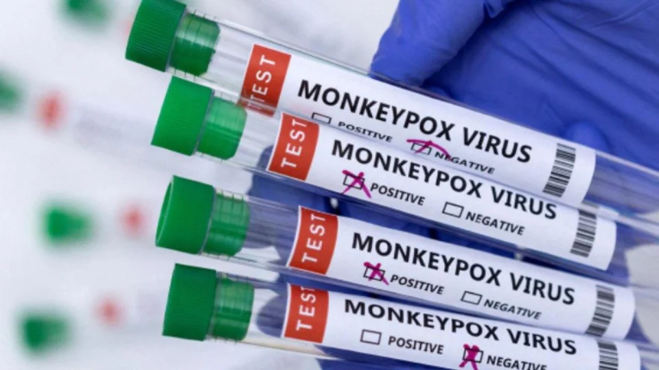 Três pessoas são monitoradas com sintomas da varíola dos macacos no Brasil, confirma MS