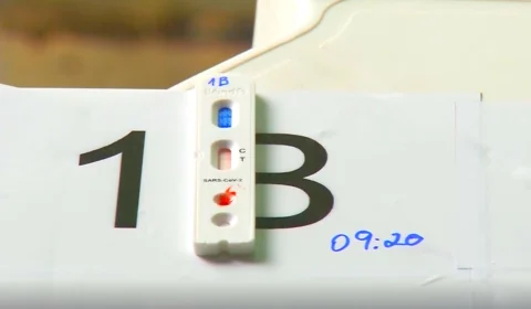 Amazonas não registra óbito, mas confirma 58 novos casos de Covid-19