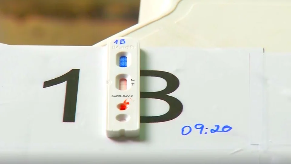 Amazonas não registra óbito, mas confirma 58 novos casos de Covid-19