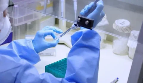 Monkeypox: sobe para 75 número de casos confirmados da varíola dos macacos no AM