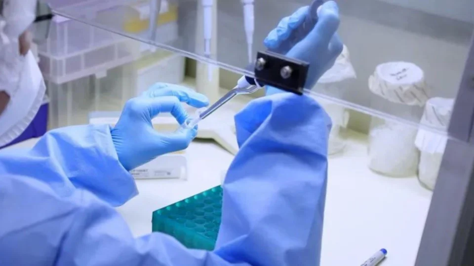 Monkeypox: sobe para 75 número de casos confirmados da varíola dos macacos no AM