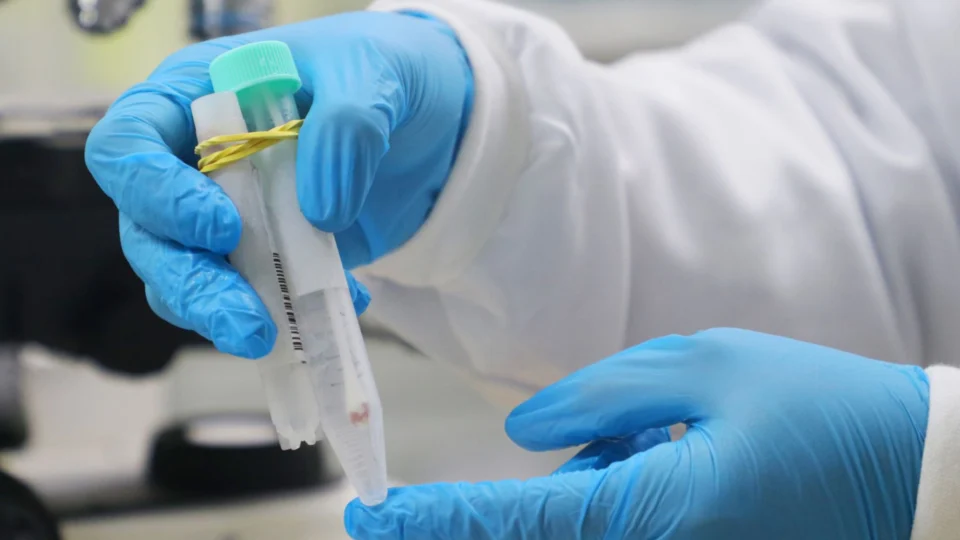 Monkeypox: AM contabiliza 202 casos confirmados e outros 45 em investigação