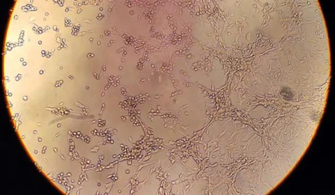 Sétima morte por varíola dos macacos é confirmada no Brasil