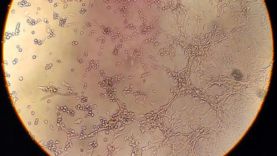 Sétima morte por varíola dos macacos é confirmada no Brasil