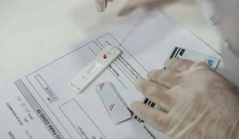 BE.9, nova variante da ômicron, é identificada pela Fiocruz no Amazonas