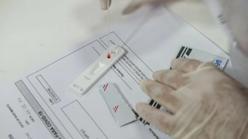 Amazonas registra 81 casos e nenhuma morte por Covid-19 neste domingo