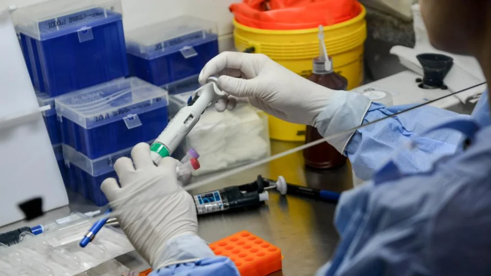 Sobe para 147 número de casos confirmados da varíola dos macacos no AM