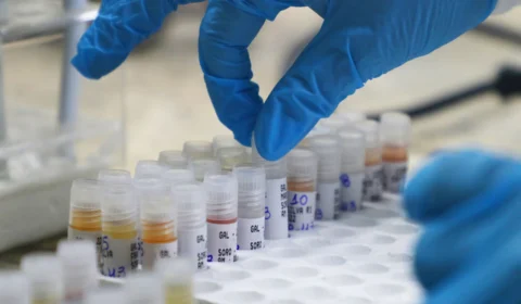 Mpox: Amazonas confirma 4 notificações de casos suspeitos da Varíola Símia