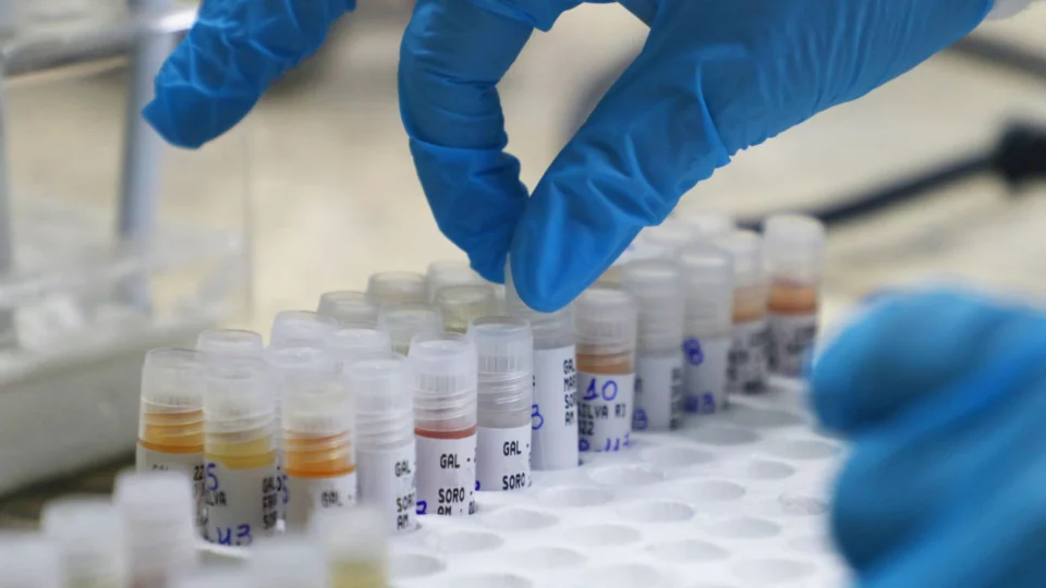 Mpox: Amazonas contabiliza 348 casos confirmados da Varíola Símia