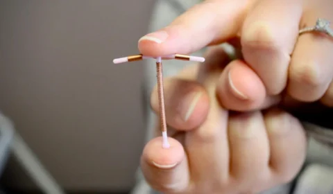 Inserção de DIU é ofertada gratuitamente em unidades de saúde de Manaus