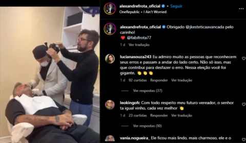 Alexandre Frota compartilha antes e depois de procedimento estético