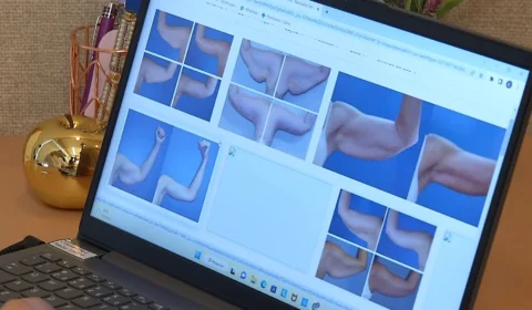 VÍDEO: Manaus está entre as cidades com maior taxa de obesidade da região norte