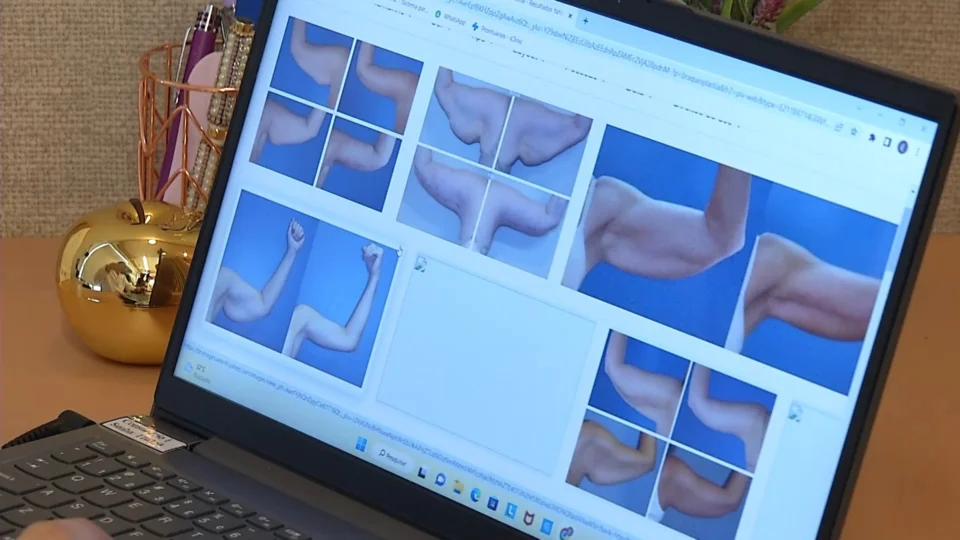 VÍDEO: Manaus está entre as cidades com maior taxa de obesidade da região norte