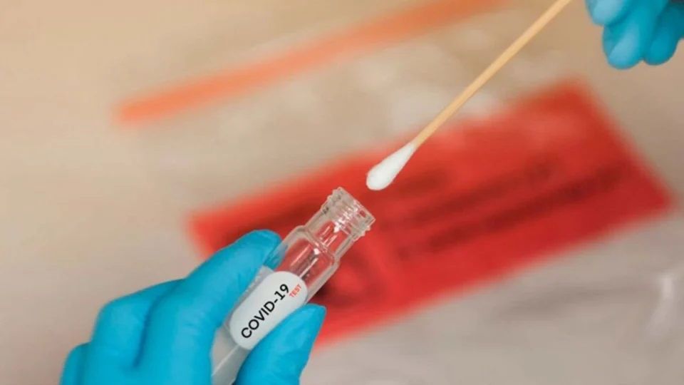 Boletim Covid-19: AM registra 200 novos casos e 1 morte nesta segunda, 20