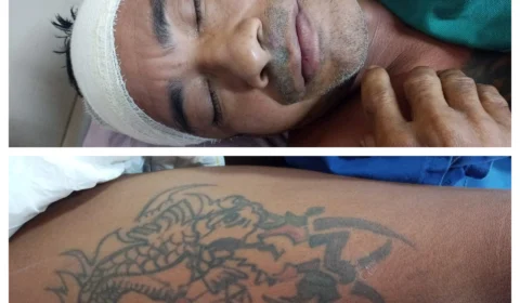 Hospital busca famílias de dois pacientes internados em Manaus