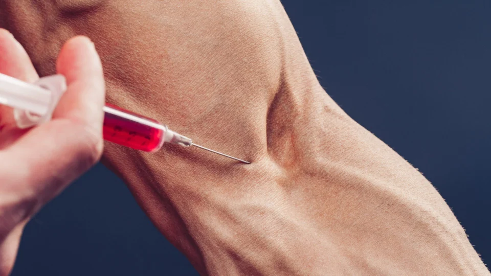 CFM proíbe prescrição de anabolizantes e androgênicos no Brasil