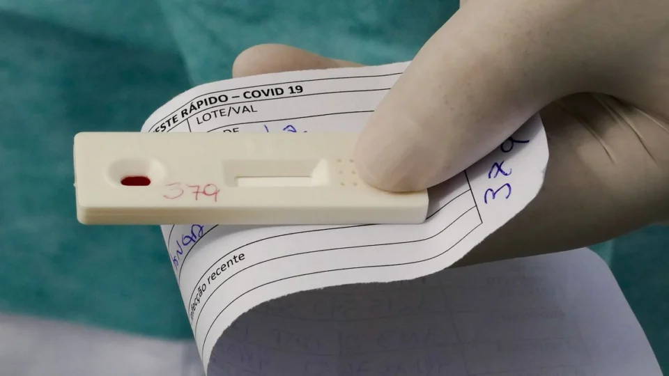 Boletim Covid-19: Amazonas registra 141 novos casos em uma semana