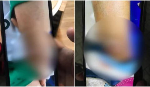 VÍDEO: criança vai à escola com sinais de violência e autoridades são acionadas