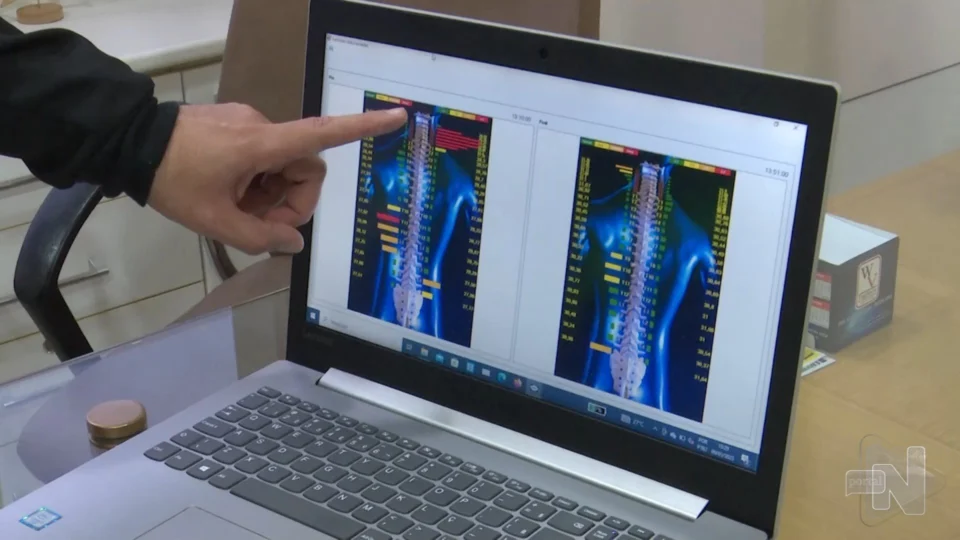 Saiba quais são os benefícios da quiropraxia a curto e longo prazo; veja vídeo