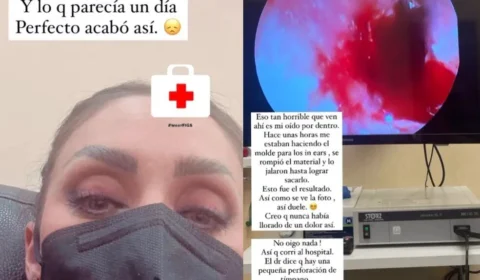 Anahí, do RBD, revela que teve tímpano perfurado ao fazer molde de fone