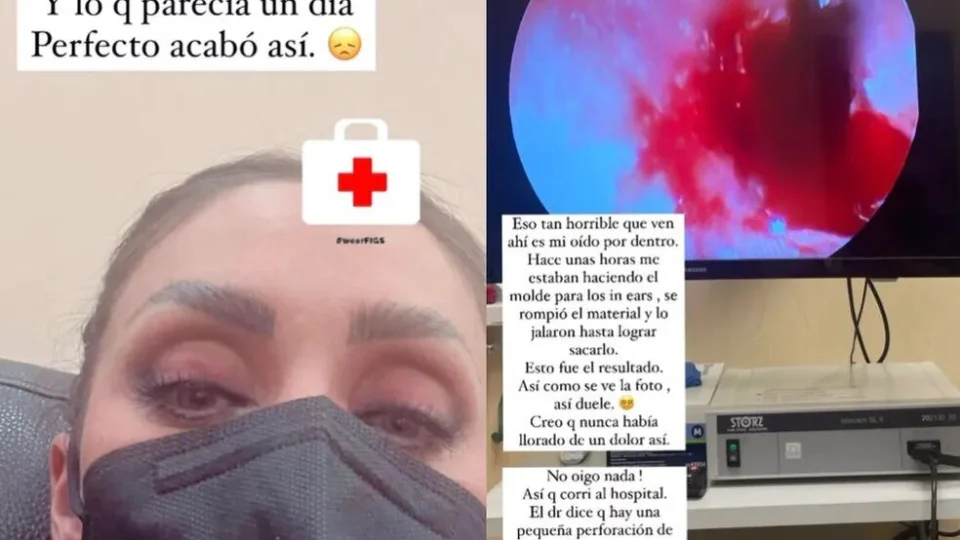 Anahí, do RBD, revela que teve tímpano perfurado ao fazer molde de fone