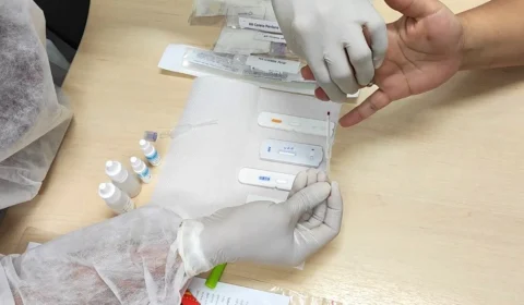 HPV: Rio Branco integra pesquisa nacional com exame gratuito para jovens