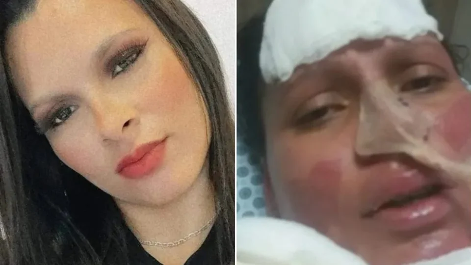 Mulher acorda de coma e denuncia marido por tentativa de homicídio, em SP