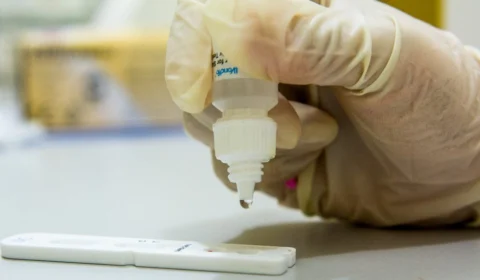 Boa Vista registrou 419 casos de sífilis em 2023; saiba como tratar a doença