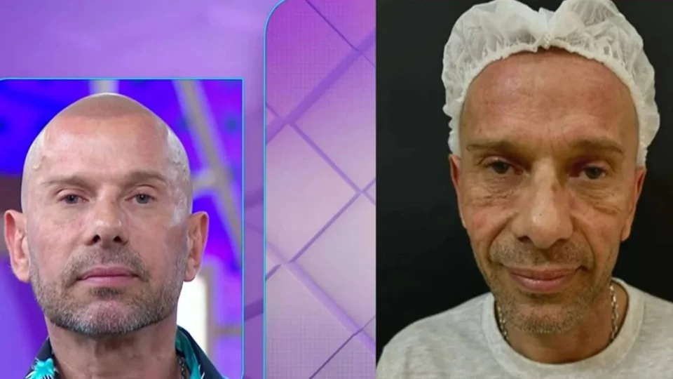 Rafael Ilha faz harmonização a convite do Fofocalizando; veja transformação