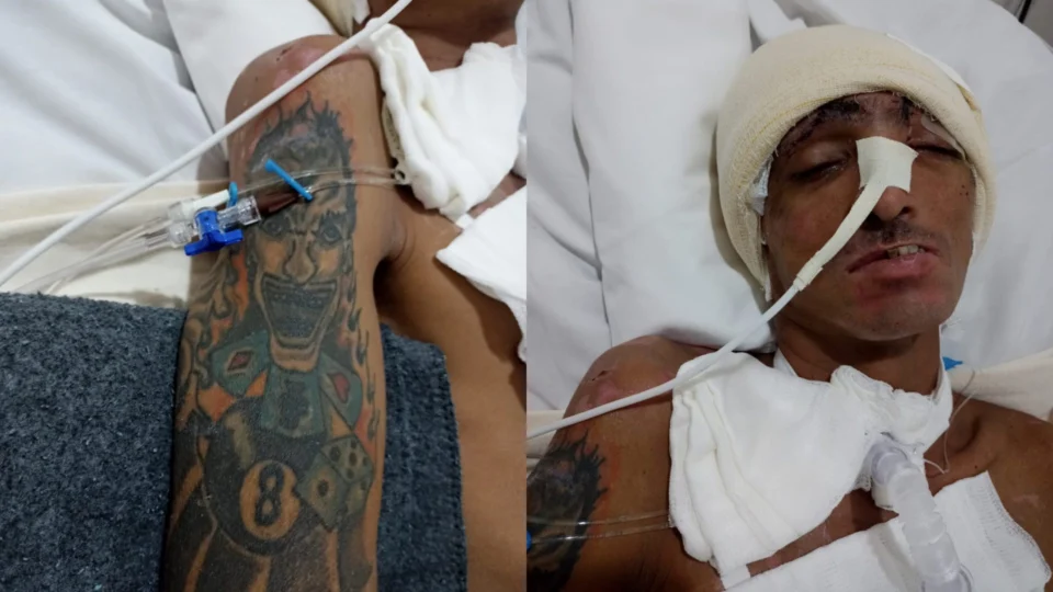 HPS João Lúcio procura familiares de paciente vítima de agressão física