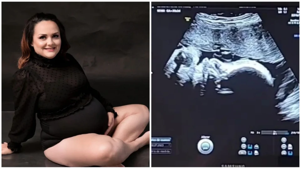 Barriga solidária: maquiadora de Goiânia-GO ajuda amigas que não engravidam