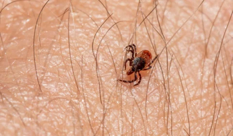 Febre maculosa: Campinas confirma 7ª morte por carrapato-estrela