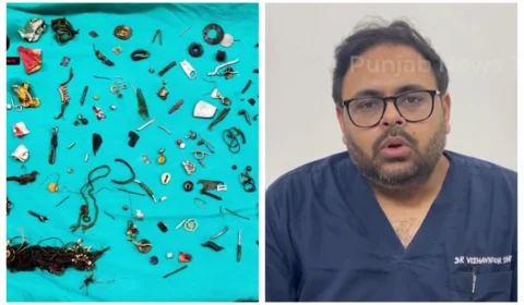 VÍDEO: médicos encontram 60 objetos em estômago de homem na Índia