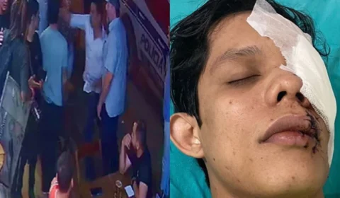 VÍDEO: empresário quebra copo de vidro no rosto de jovem em bar no Acre
