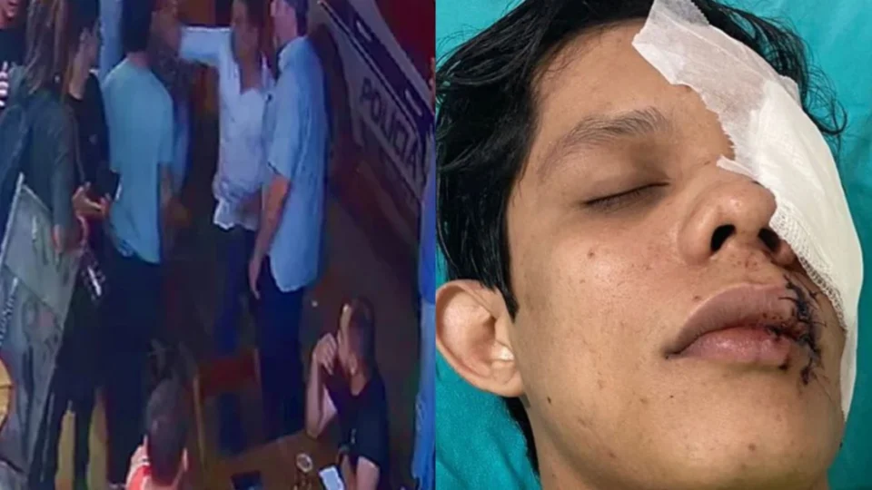 VÍDEO: empresário quebra copo de vidro no rosto de jovem em bar no Acre